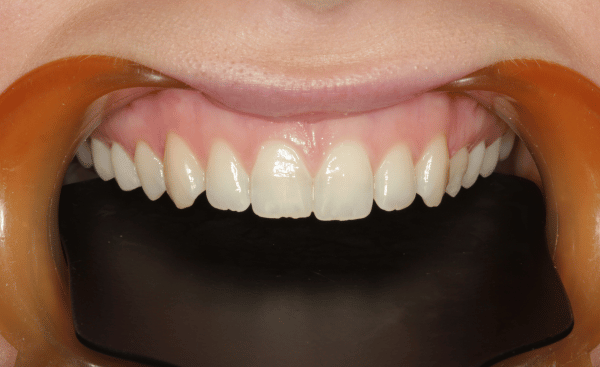 Before Image - Creffield Lodge Dental Practice