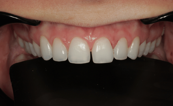 Before Image - Creffield Lodge Dental Practice