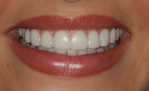 After Image - Creffield Lodge Dental Practice