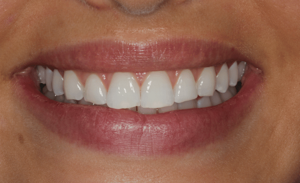 Before Image - Creffield Lodge Dental Practice
