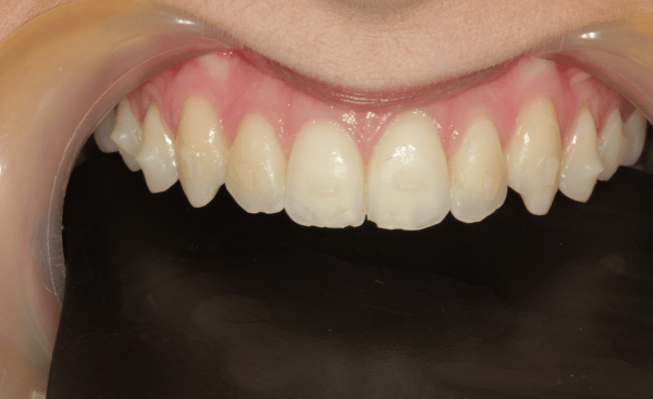 Before Image - Creffield Lodge Dental Practice