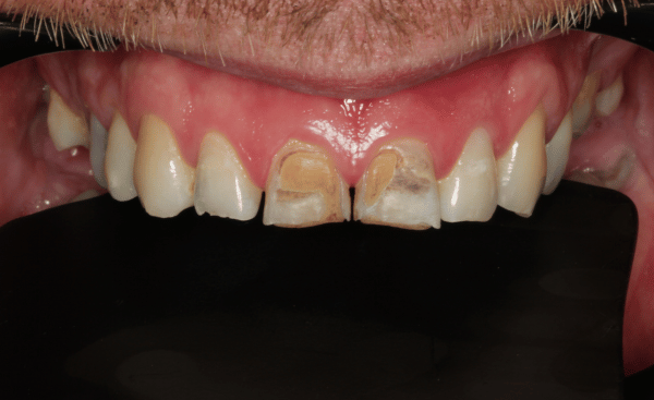 Before Image - Creffield Lodge Dental Practice