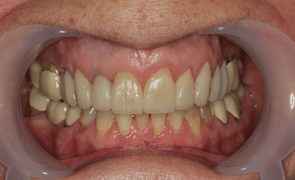 After Image - Creffield Lodge Dental Practice