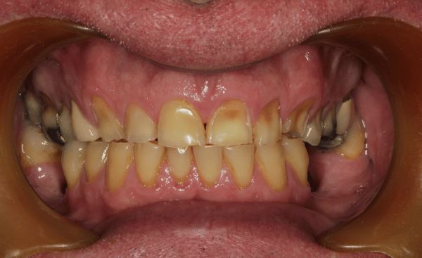 Before Image - Creffield Lodge Dental Practice