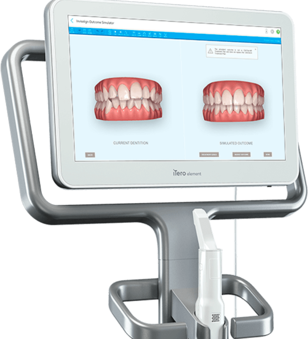 3D Scanner