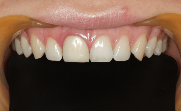 Before Image - Creffield Lodge Dental Practice
