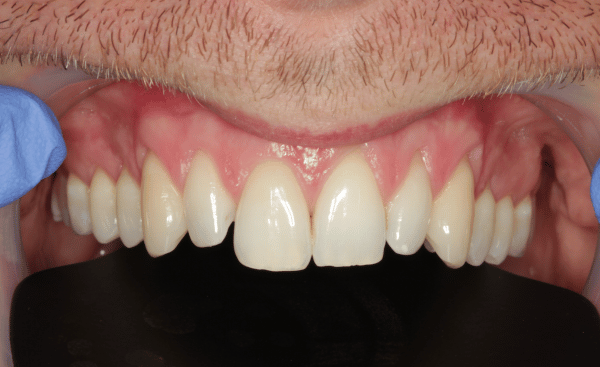 Before Image - Creffield Lodge Dental Practice