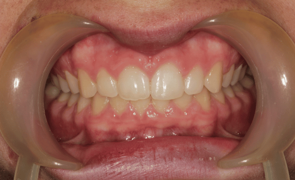 After Image - Creffield Lodge Dental Practice