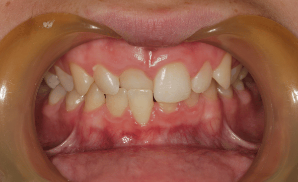Before Image - Creffield Lodge Dental Practice