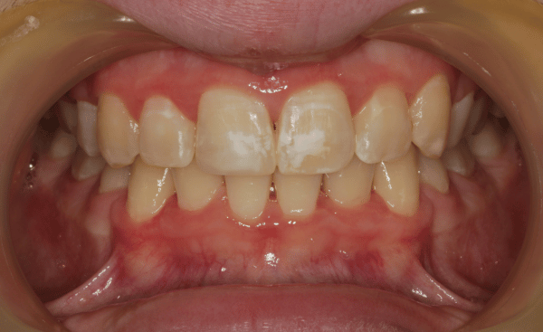 After Image - Creffield Lodge Dental Practice