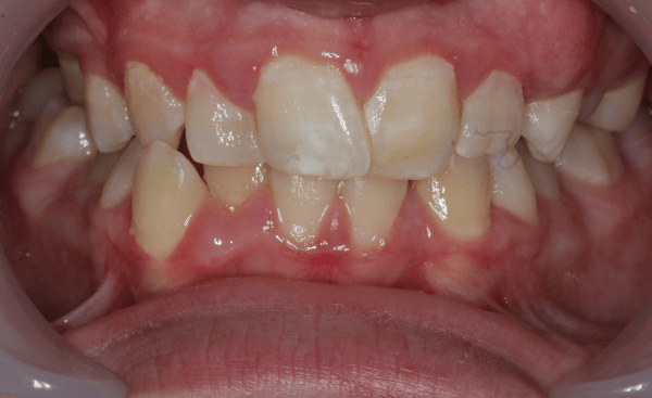 Before Image - Creffield Lodge Dental Practice