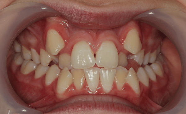 Before Image - Creffield Lodge Dental Practice