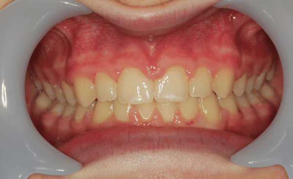 After Image - Creffield Lodge Dental Practice