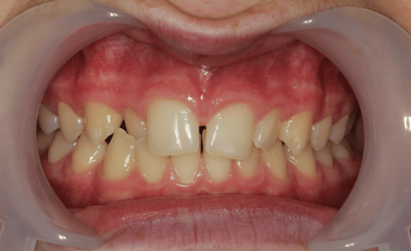 Before Image - Creffield Lodge Dental Practice